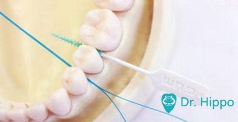 全面口腔护理指南 从清洁牙齿到整体健康