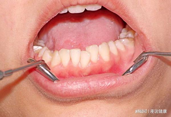 口腔问题频频出现？别不当回事，它的健康与全身健康息息相关！