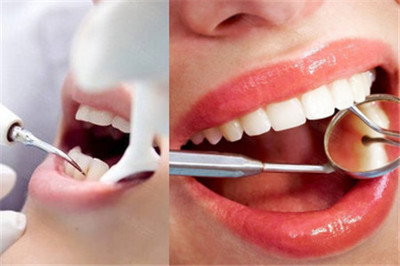 牙根尖炎能自愈吗？正确的处理方法与口腔护理